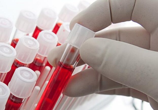 exame de sangue depois de beber álcool